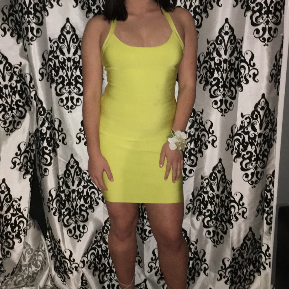 Neon yellow bandage bodycon Marciano mini dress 🌟